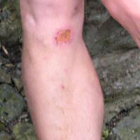 Saul's Crack Knee (Roger Dyke)